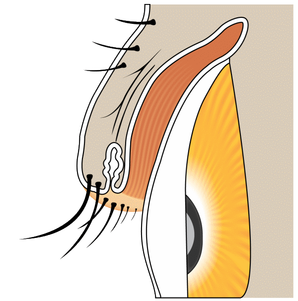 Diagram: normal eyelash anatomy and direction