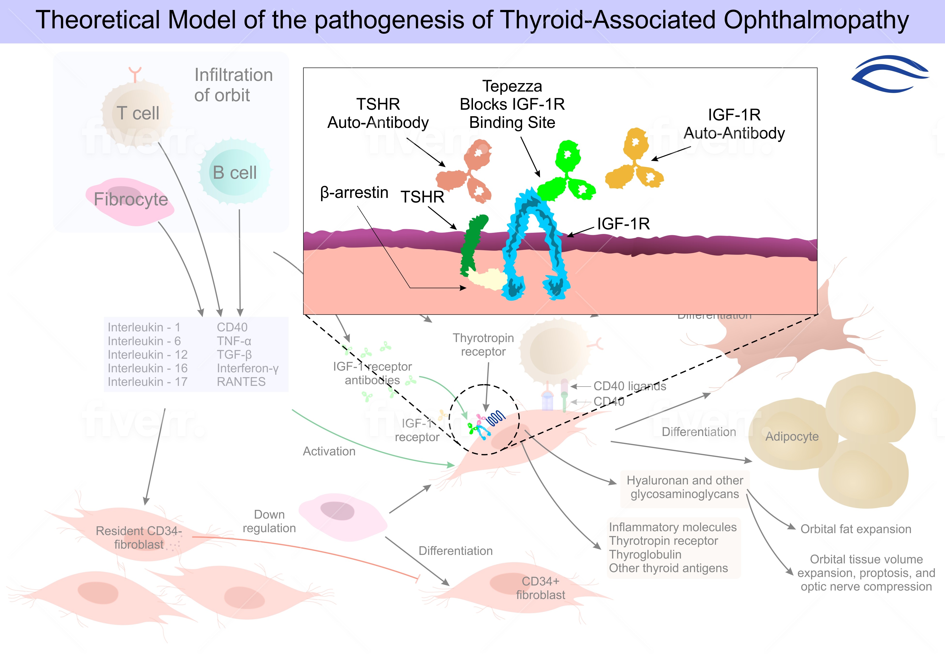 Tepezza treatment result — proptosis reduction in Thyroid Eye Disease